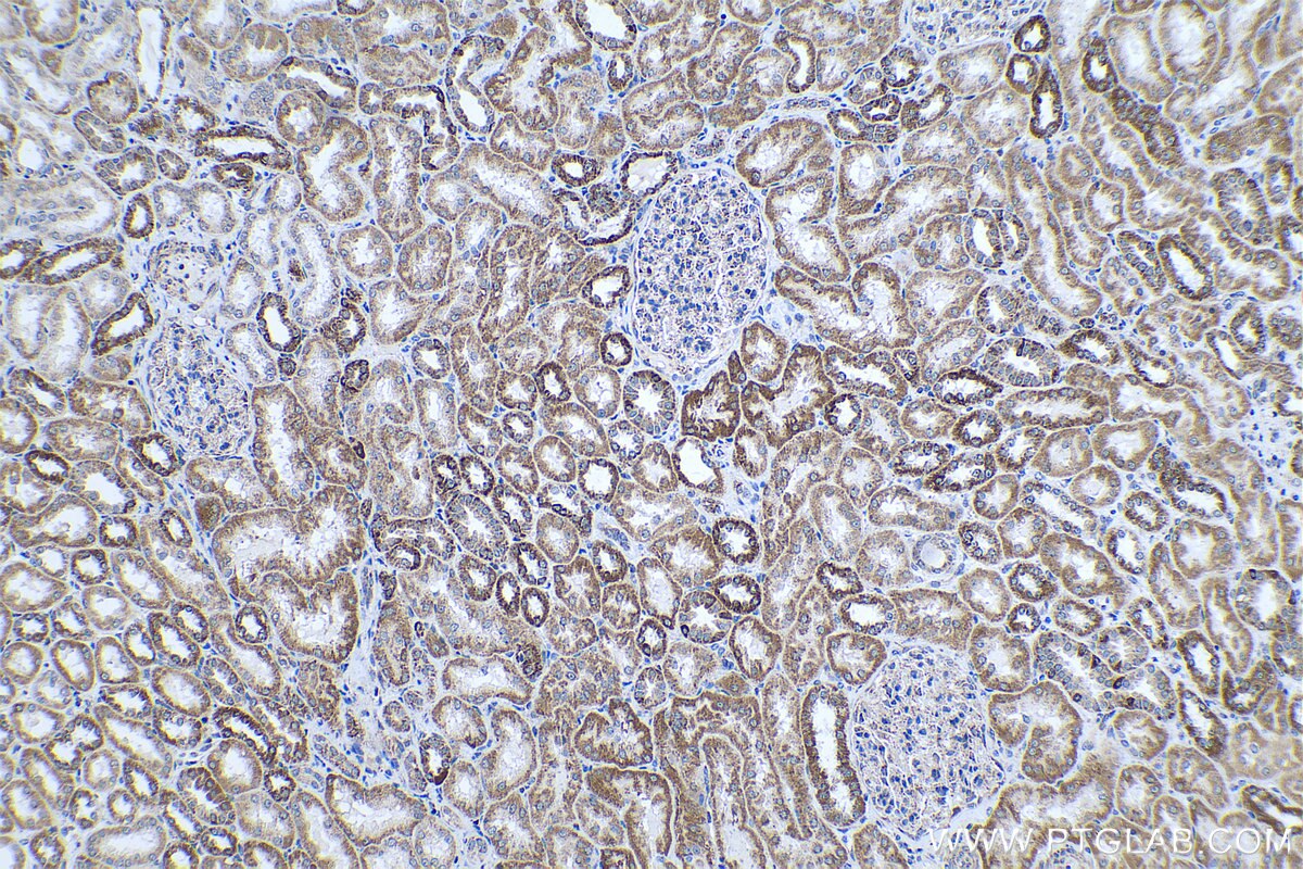 Immunohistochemical analysis of paraffin-embedded human kidney tissue slide using KHC0332 (CPT1A IHC Kit).