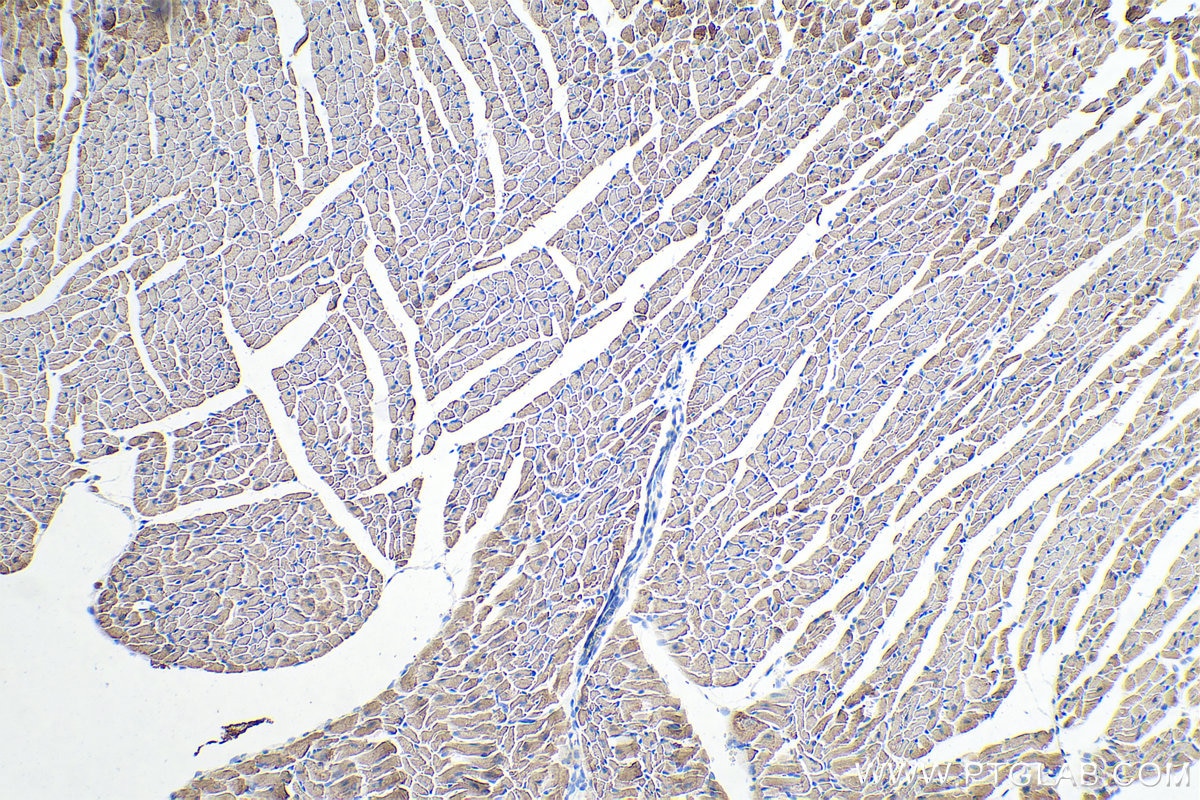 Immunohistochemical analysis of paraffin-embedded mouse heart tissue slide using KHC0332 (CPT1A IHC Kit).