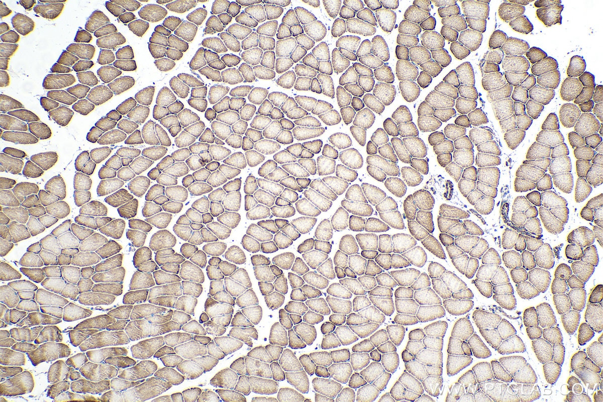 Immunohistochemical analysis of paraffin-embedded mouse skeletal muscle tissue slide using KHC0332 (CPT1A IHC Kit).