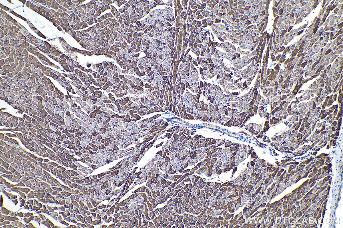 Immunohistochemical analysis of paraffin-embedded rat heart tissue slide using KHC0332 (CPT1A IHC Kit).