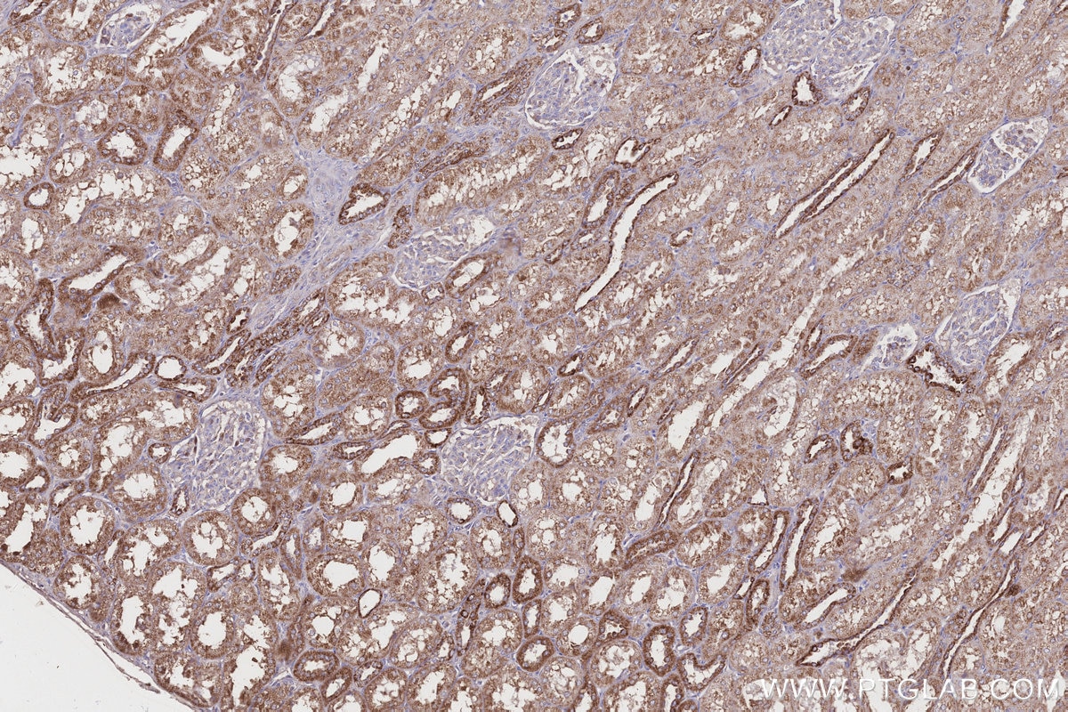 Immunohistochemical analysis of paraffin-embedded human kidney tissue slide using KHC0332 (CPT1A IHC Kit).
