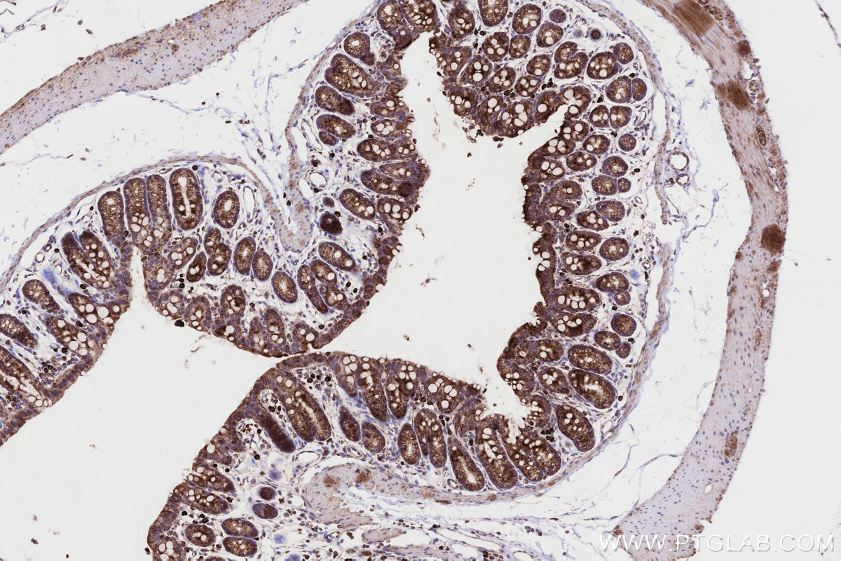 Immunohistochemical analysis of paraffin-embedded mouse colon tissue slide using KHC0332 (CPT1A IHC Kit).