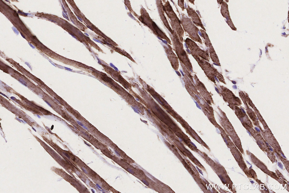 Immunohistochemical analysis of paraffin-embedded mouse heart tissue slide using KHC0332 (CPT1A IHC Kit).