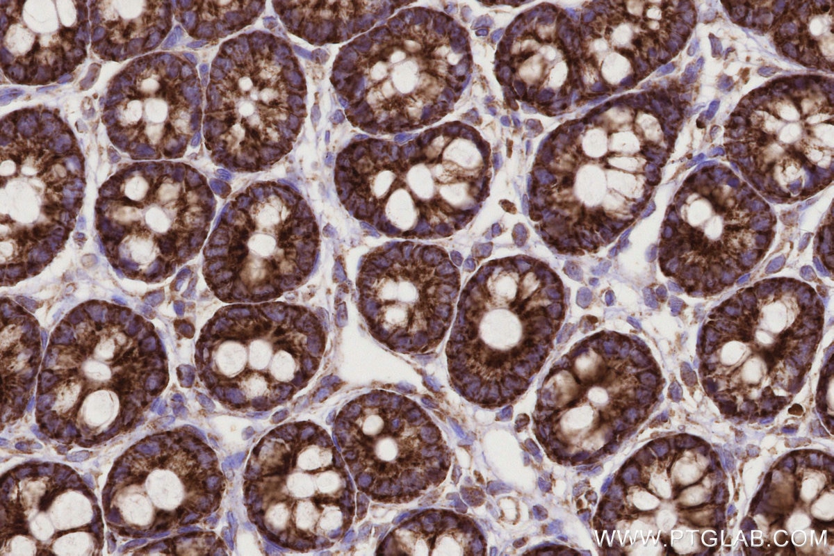 Immunohistochemical analysis of paraffin-embedded rat colon tissue slide using KHC0332 (CPT1A IHC Kit).