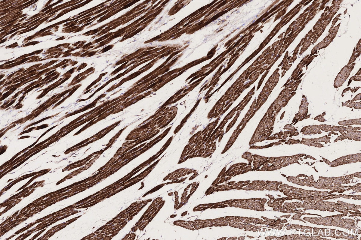 Immunohistochemical analysis of paraffin-embedded rat heart tissue slide using KHC0332 (CPT1A IHC Kit).