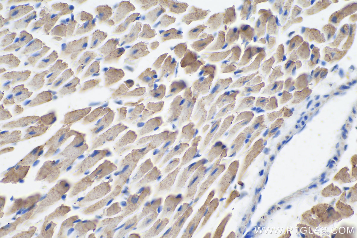 Immunohistochemical analysis of paraffin-embedded mouse heart tissue slide using KHC0363 (CPT1B-specific IHC Kit).