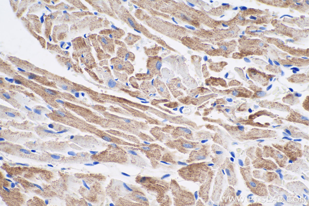 Immunohistochemical analysis of paraffin-embedded rat heart tissue slide using KHC0363 (CPT1B-specific IHC Kit).