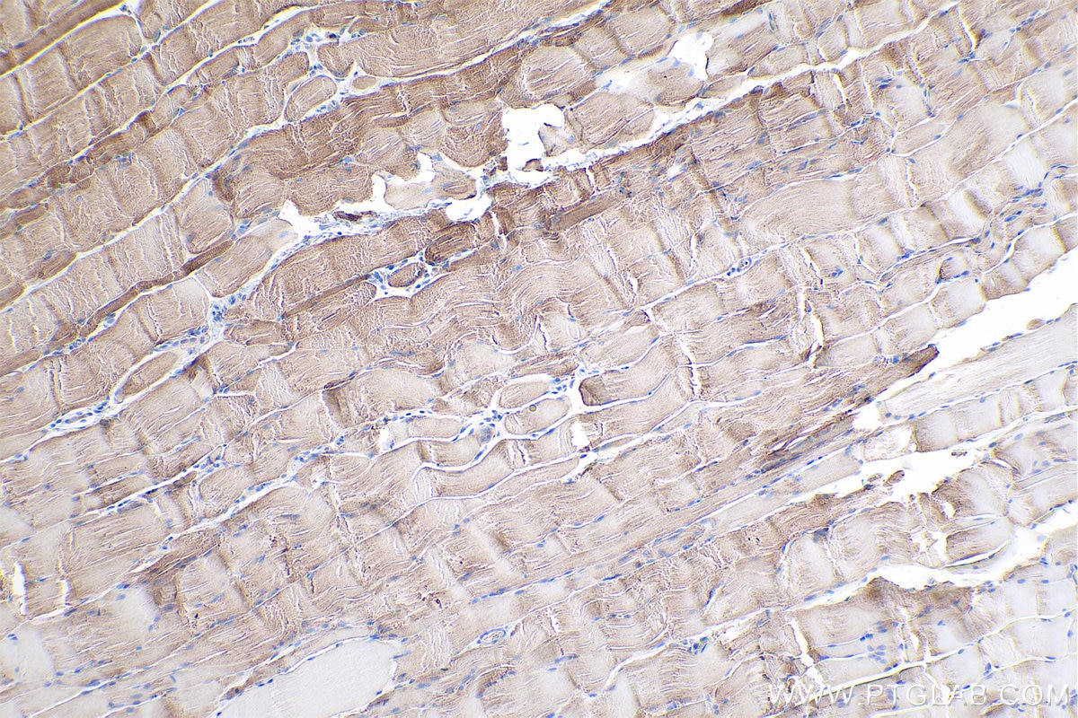 Immunohistochemical analysis of paraffin-embedded rat skeletal muscle tissue slide using KHC0363 (CPT1B-specific IHC Kit).