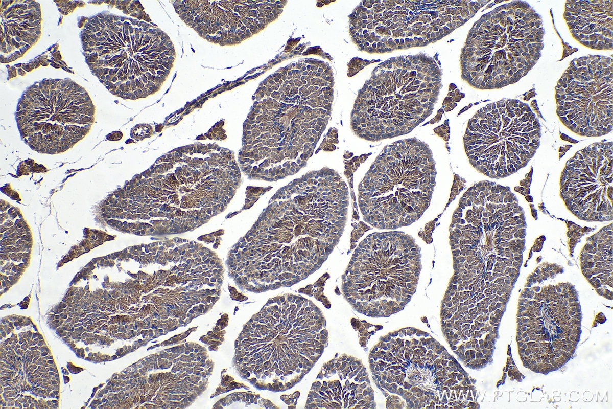 Immunohistochemical analysis of paraffin-embedded mouse testis tissue slide using KHC0333 (CPT1C IHC Kit).