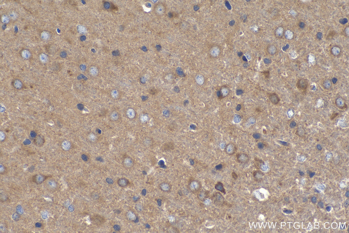 Immunohistochemical analysis of paraffin-embedded rat brain tissue slide using KHC0333 (CPT1C IHC Kit).