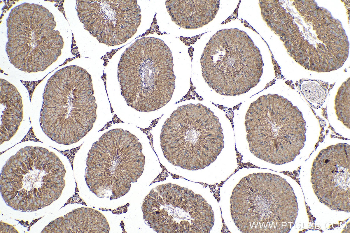 Immunohistochemical analysis of paraffin-embedded rat testis tissue slide using KHC0333 (CPT1C IHC Kit).