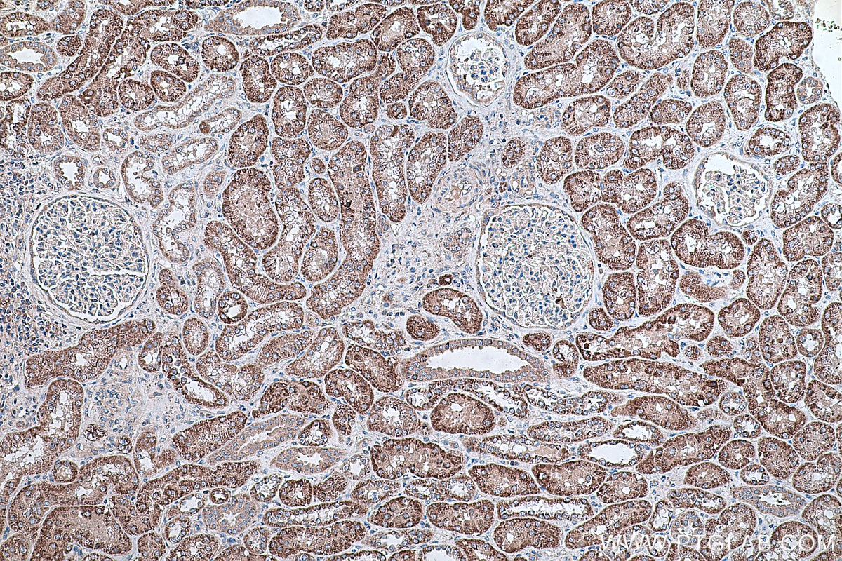 Immunohistochemical analysis of paraffin-embedded human kidney tissue slide using KHC0334 (CPT2 IHC Kit).