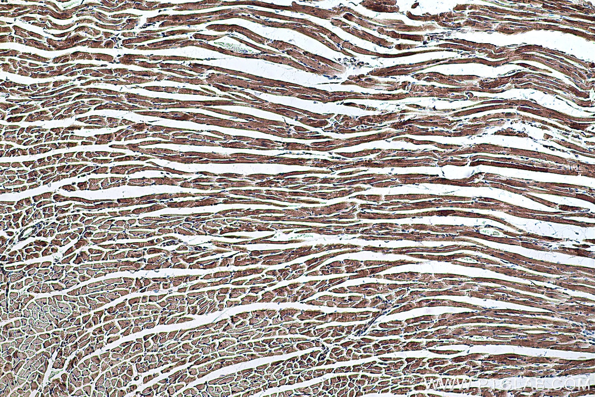 Immunohistochemical analysis of paraffin-embedded mouse heart tissue slide using KHC0334 (CPT2 IHC Kit).