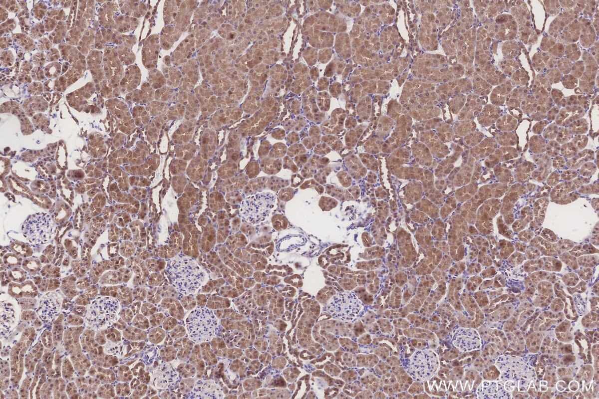 Immunohistochemical analysis of paraffin-embedded rat kidney tissue slide using KHC3263 (CPTP IHC Kit).
