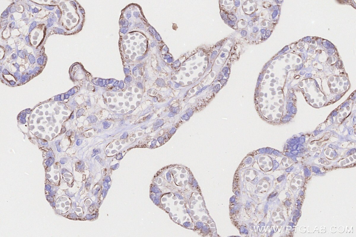 Immunohistochemical analysis of paraffin-embedded human placenta tissue slide using KHC3263 (CPTP IHC Kit).