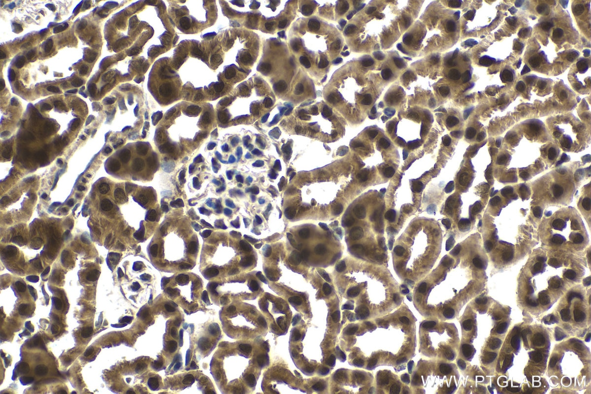 Immunohistochemical analysis of paraffin-embedded mouse kidney tissue slide using KHC1654 (CRADD IHC Kit).