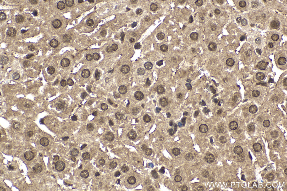 Immunohistochemical analysis of paraffin-embedded mouse liver tissue slide using KHC1654 (CRADD IHC Kit).
