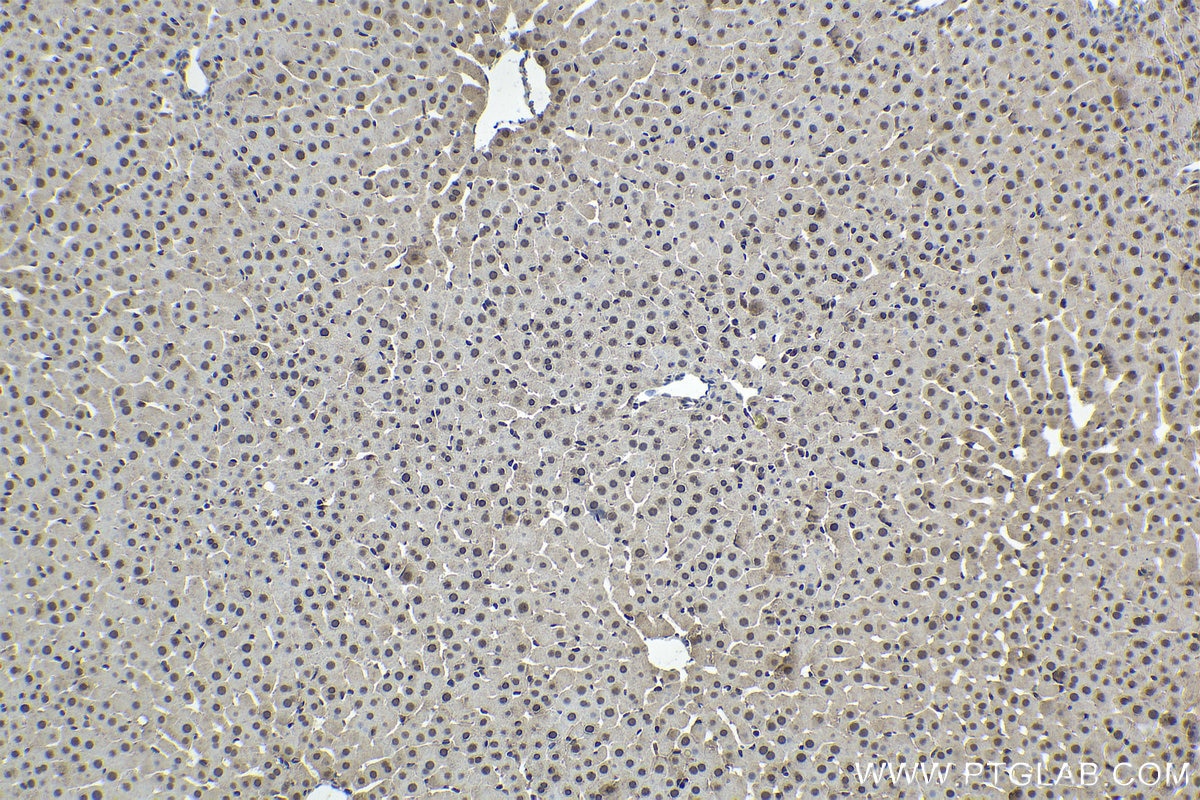 Immunohistochemical analysis of paraffin-embedded rat liver tissue slide using KHC1654 (CRADD IHC Kit).