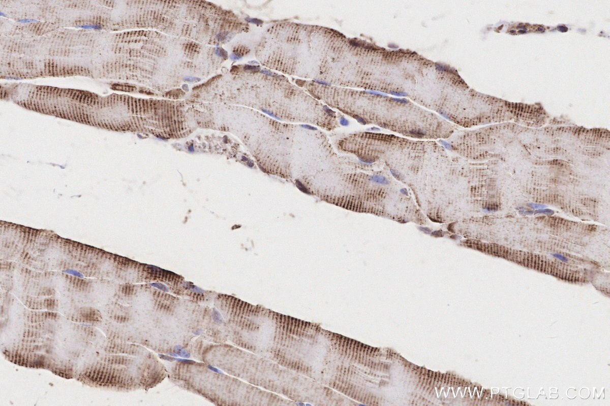 Immunohistochemical analysis of paraffin-embedded mouse skeletal muscle tissue slide using KHC3209 (CRAT IHC Kit).