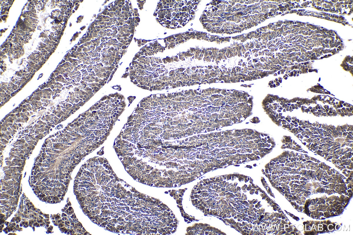 Immunohistochemical analysis of paraffin-embedded mouse testis tissue slide using KHC1019 (CRCP IHC Kit).