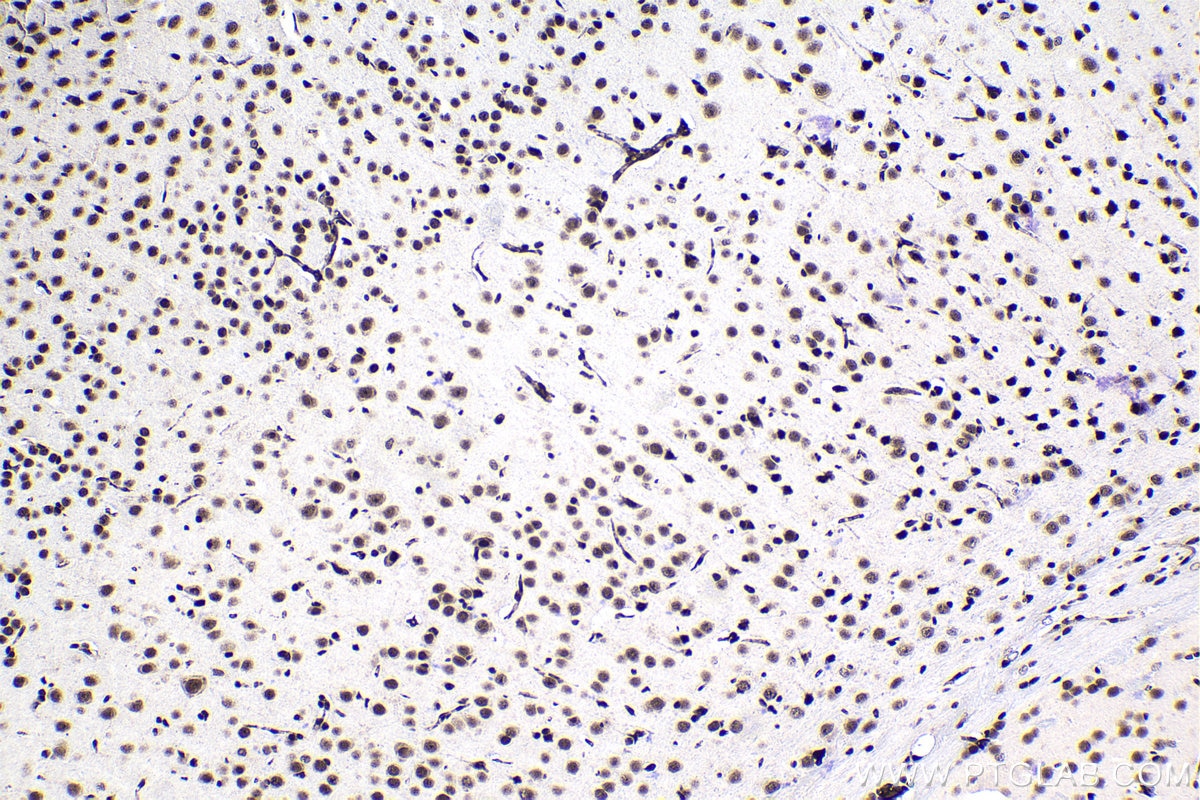 Immunohistochemical analysis of paraffin-embedded mouse brain tissue slide using KHC1124 (CREB1 IHC Kit).