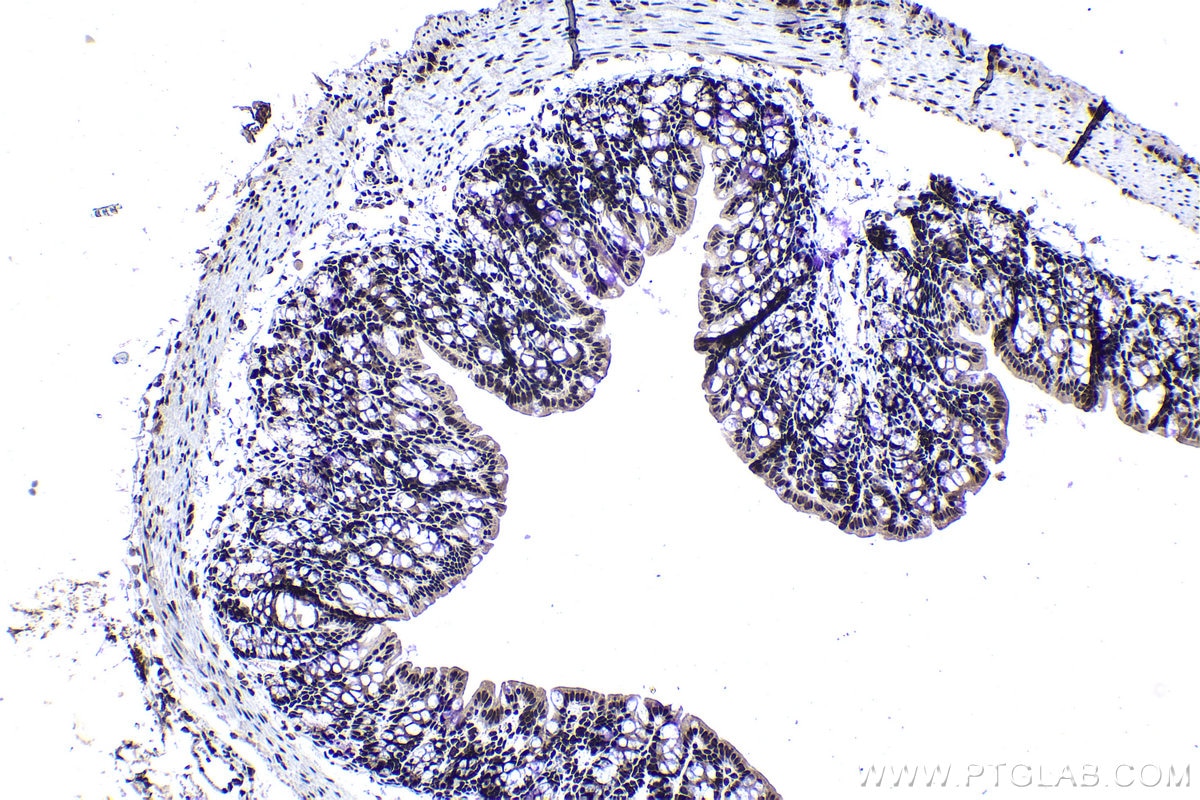 Immunohistochemical analysis of paraffin-embedded mouse colon tissue slide using KHC1124 (CREB1 IHC Kit).