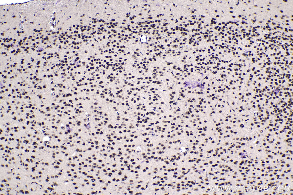 Immunohistochemical analysis of paraffin-embedded rat brain tissue slide using KHC1124 (CREB1 IHC Kit).