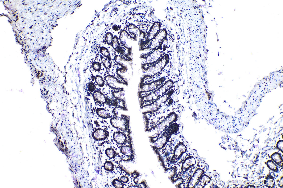 Immunohistochemical analysis of paraffin-embedded rat colon tissue slide using KHC1124 (CREB1 IHC Kit).