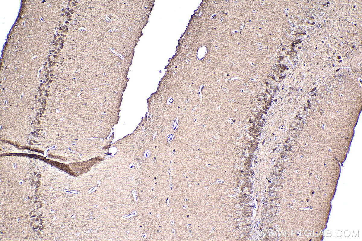 Immunohistochemical analysis of paraffin-embedded mouse brain tissue slide using KHC1458 (CREB3 IHC Kit).