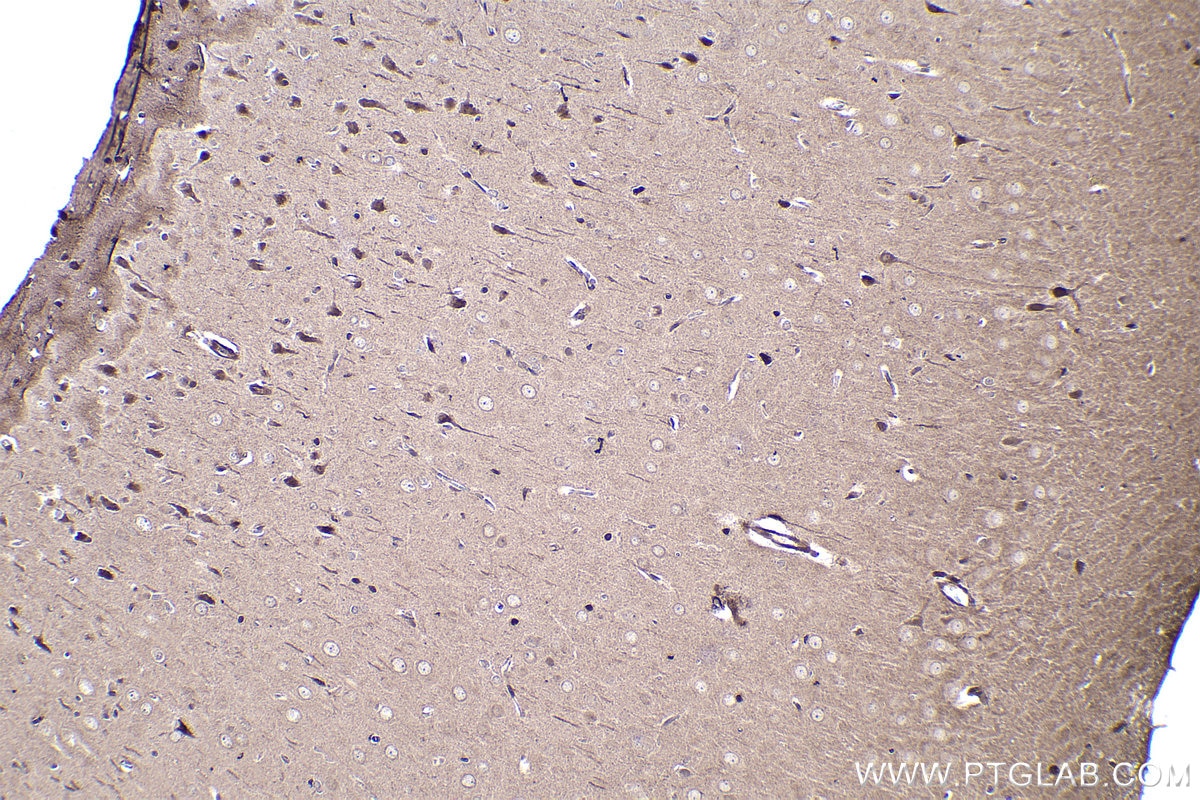 Immunohistochemical analysis of paraffin-embedded rat brain tissue slide using KHC1458 (CREB3 IHC Kit).