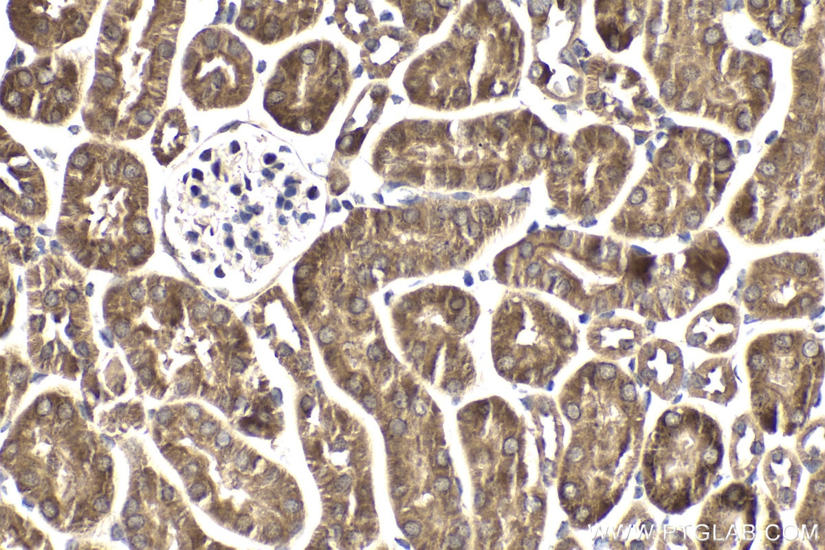 Immunohistochemical analysis of paraffin-embedded mouse kidney tissue slide using KHC1868 (CREB3L1 IHC Kit).