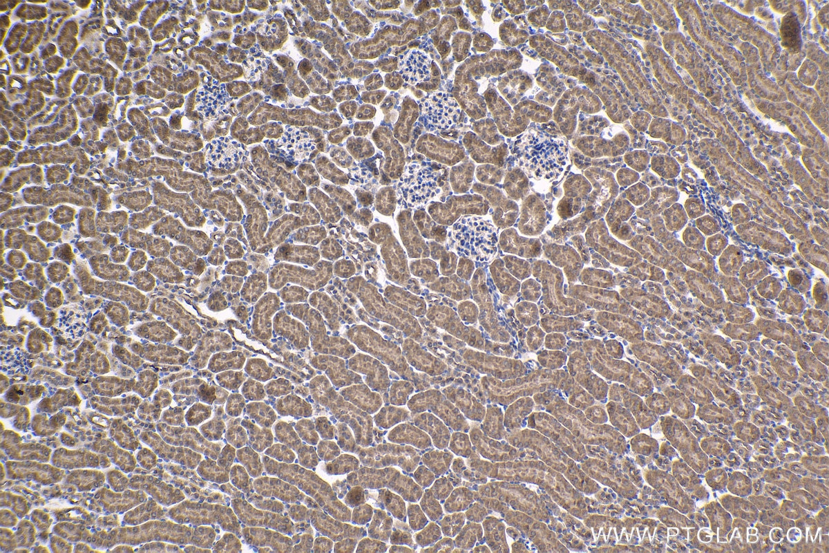 Immunohistochemical analysis of paraffin-embedded mouse kidney tissue slide using KHC1842 (CREB3L4 IHC Kit).