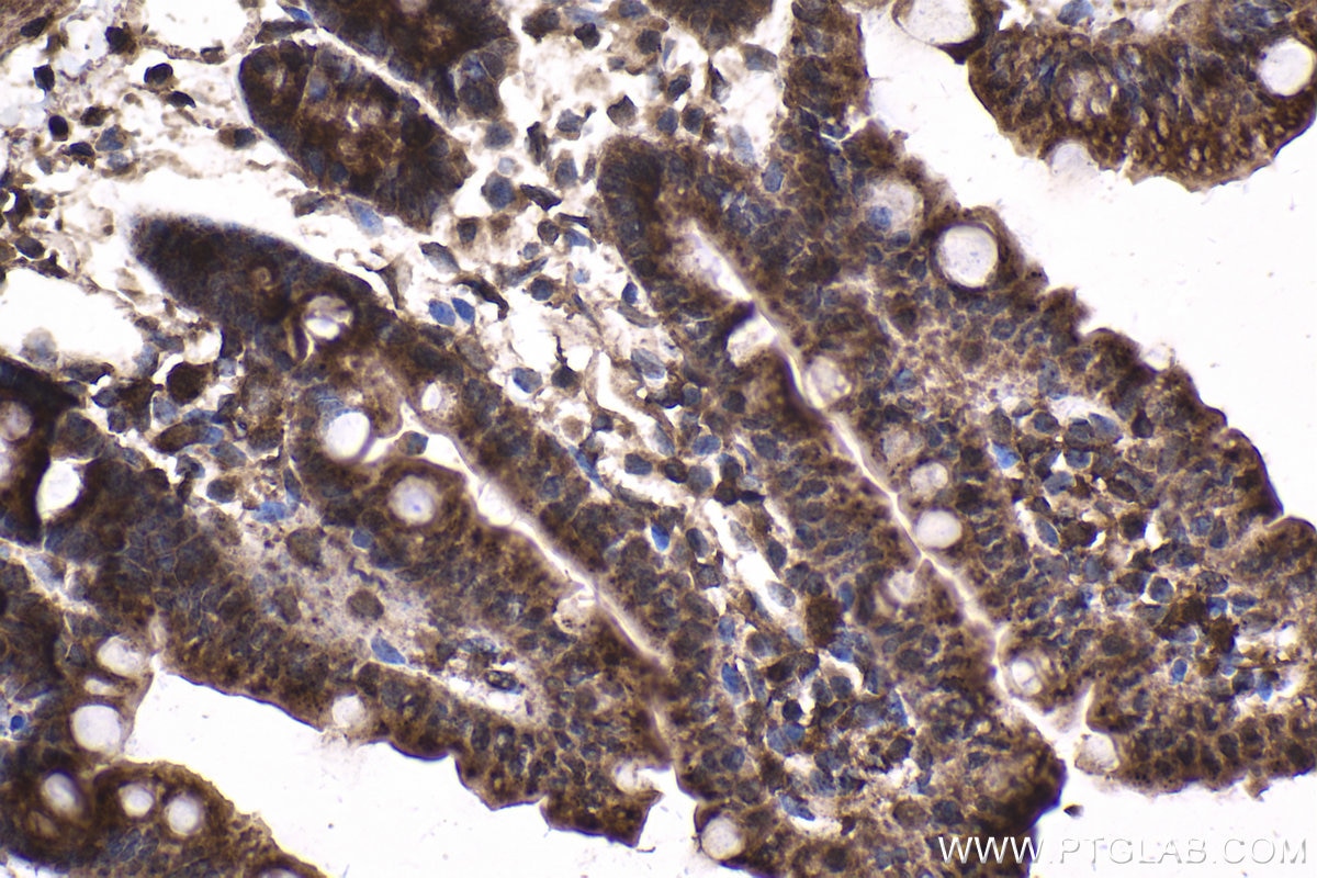 Immunohistochemical analysis of paraffin-embedded mouse small intestine tissue slide using KHC1842 (CREB3L4 IHC Kit).