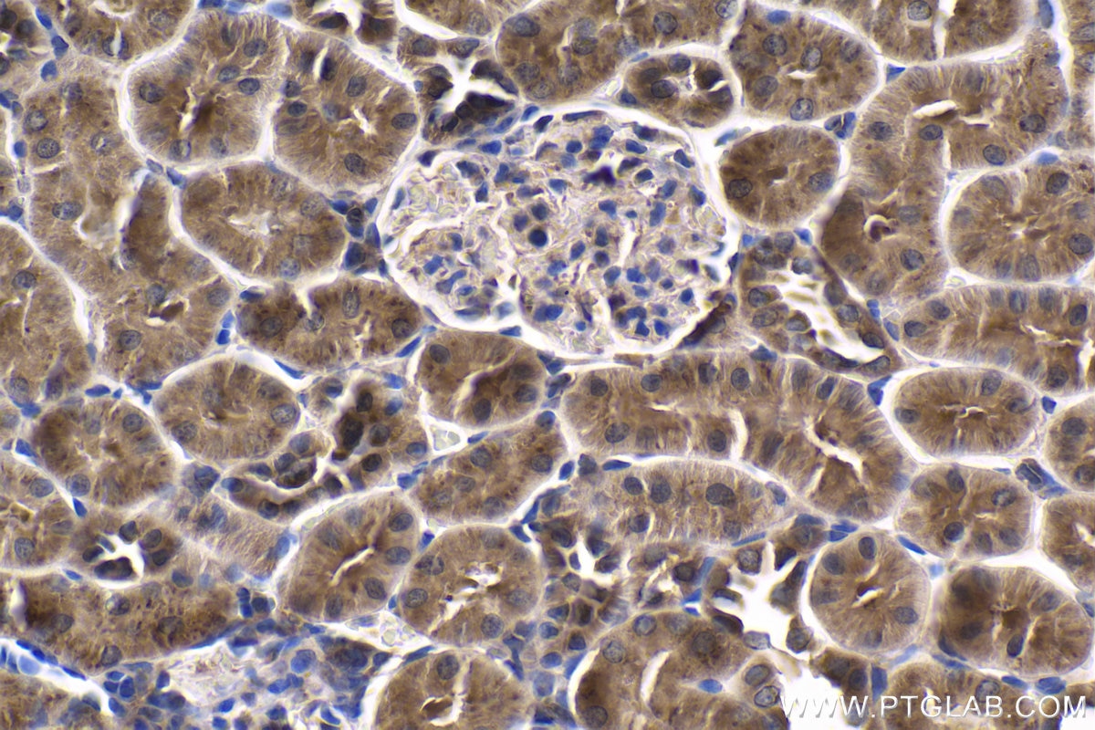 Immunohistochemical analysis of paraffin-embedded rat kidney tissue slide using KHC1842 (CREB3L4 IHC Kit).