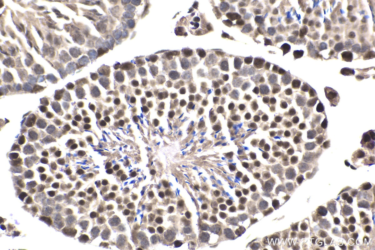 Immunohistochemical analysis of paraffin-embedded mouse testis tissue slide using KHC1856 (CREBBP IHC Kit).
