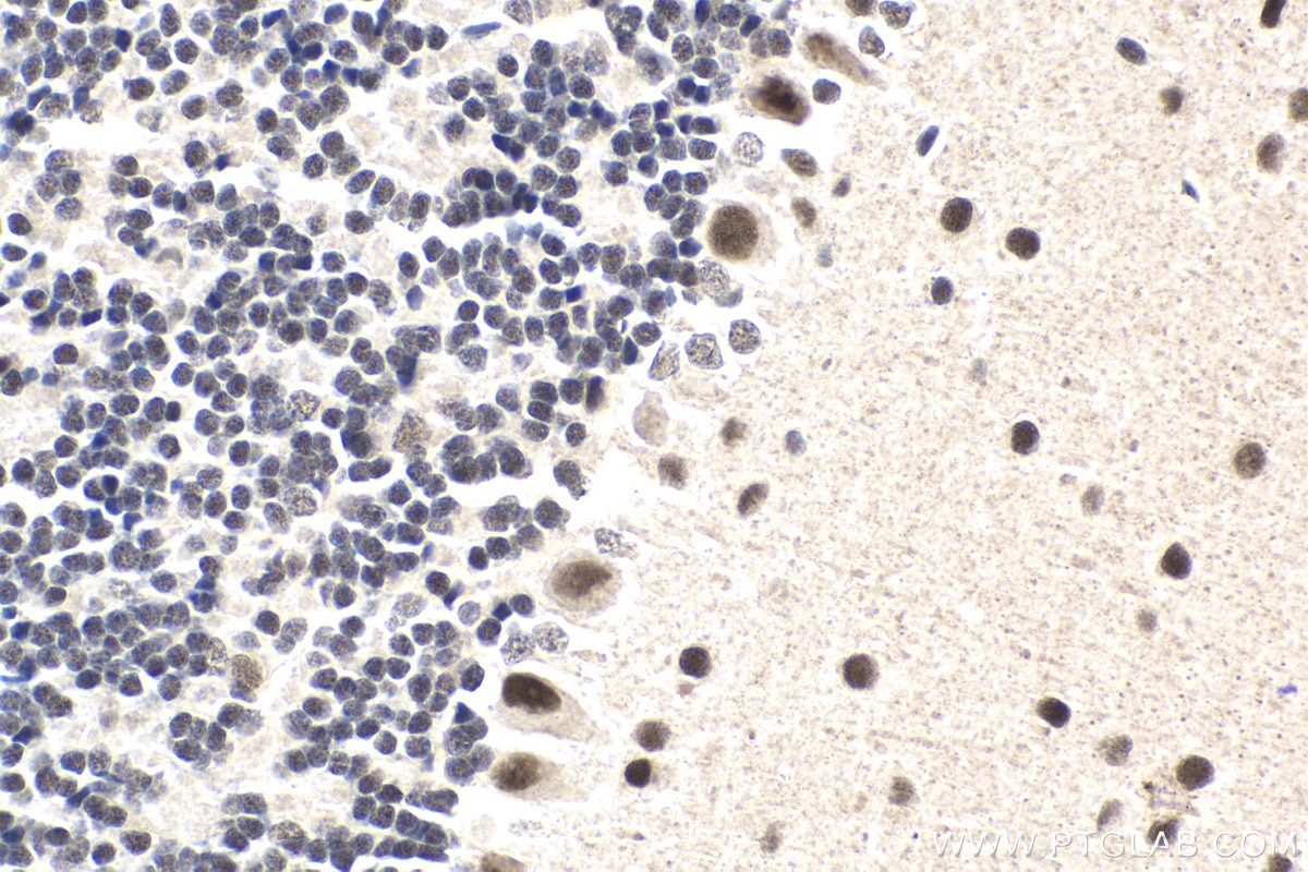 Immunohistochemical analysis of paraffin-embedded mouse cerebellum tissue slide using KHC1856 (CREBBP IHC Kit).