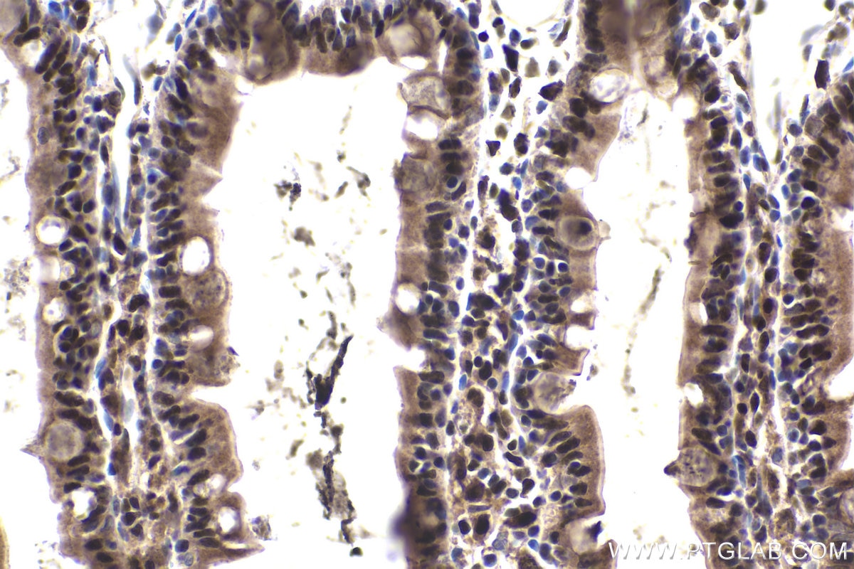 Immunohistochemical analysis of paraffin-embedded rat small intestine tissue slide using KHC1856 (CREBBP IHC Kit).