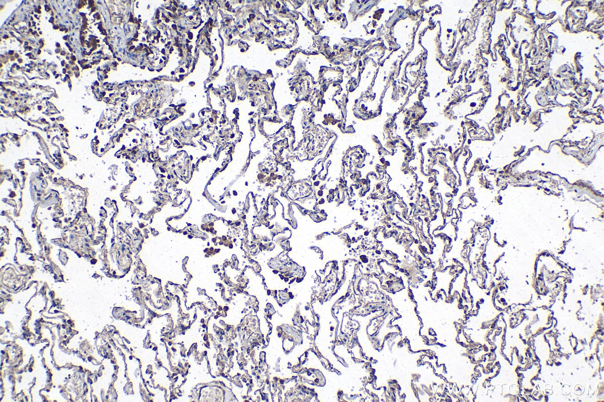 Immunohistochemical analysis of paraffin-embedded human lung tissue slide using KHC1360 (CRLS1 IHC Kit).