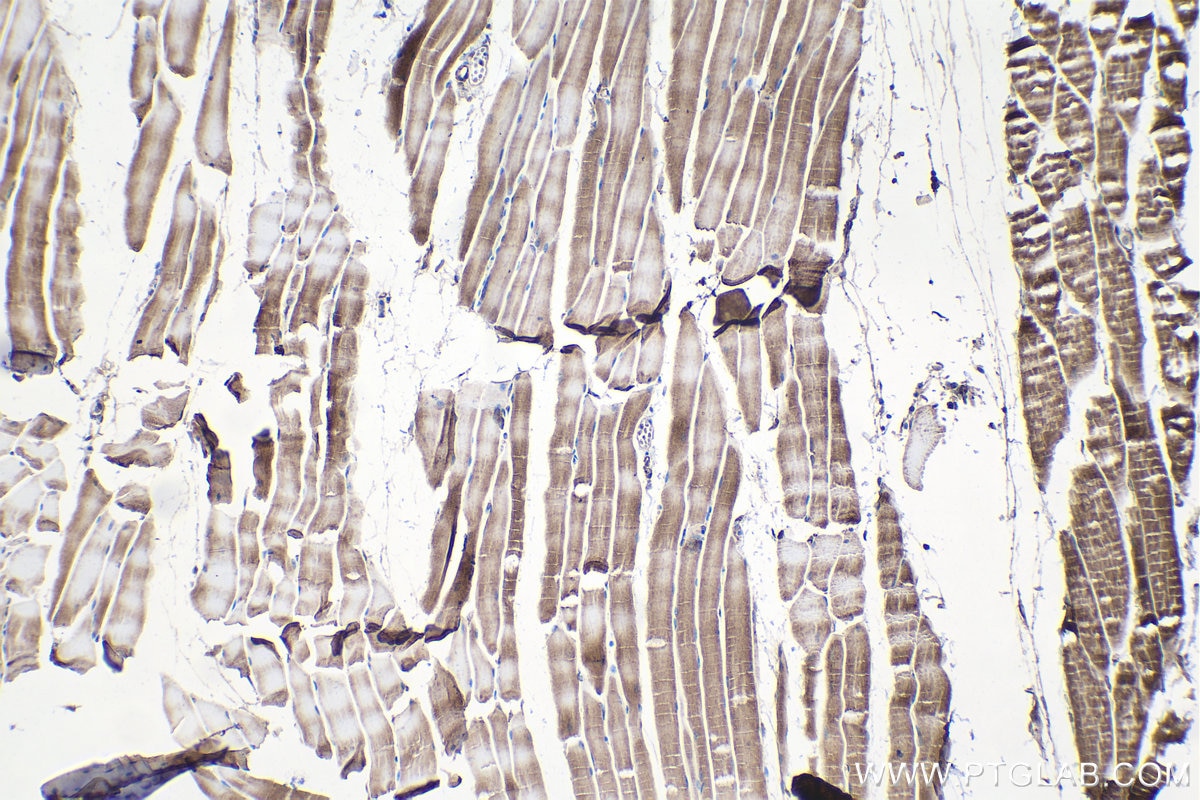 Immunohistochemical analysis of paraffin-embedded mouse skeletal muscle tissue slide using KHC1360 (CRLS1 IHC Kit).
