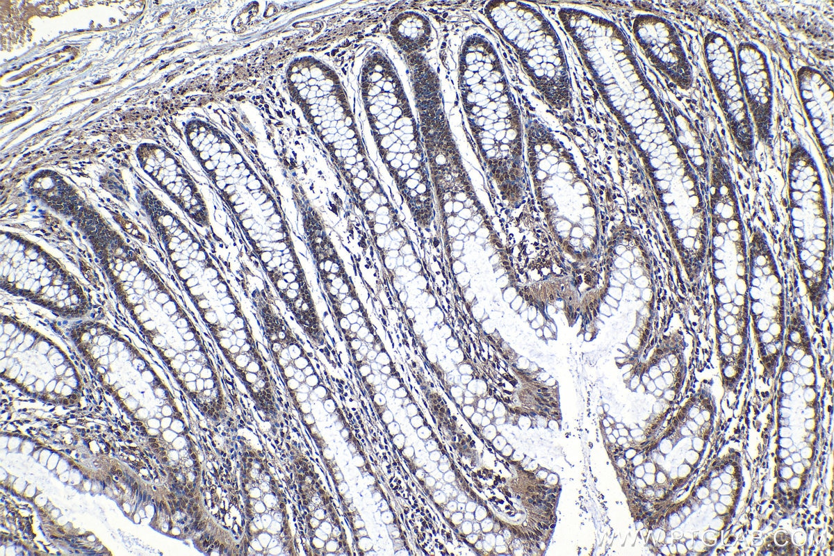 Immunohistochemical analysis of paraffin-embedded human colon tissue slide using KHC1213 (CRM1 IHC Kit).