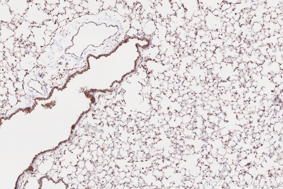 Immunohistochemical analysis of paraffin-embedded mouse lung tissue slide using KHC2559 (CROCC/Rootletin IHC Kit).