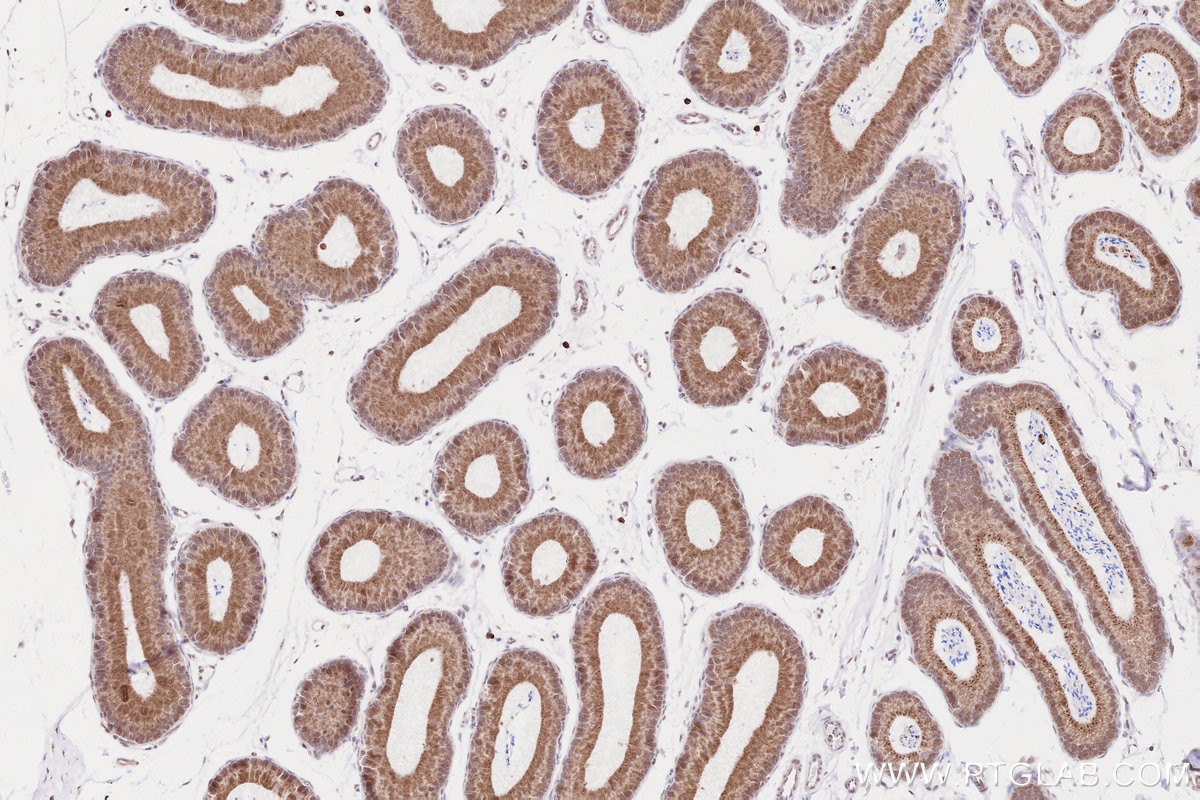 Immunohistochemical analysis of paraffin-embedded mouse epididymis tissue slide using KHC2559 (CROCC/Rootletin IHC Kit).