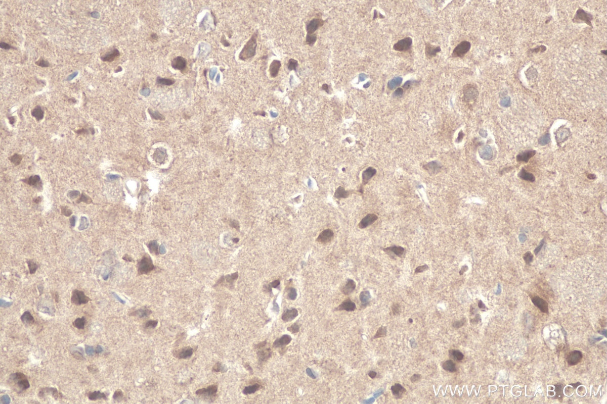 Immunohistochemical analysis of paraffin-embedded rat brain tissue slide using KHC0802 (CRTC1 IHC Kit).