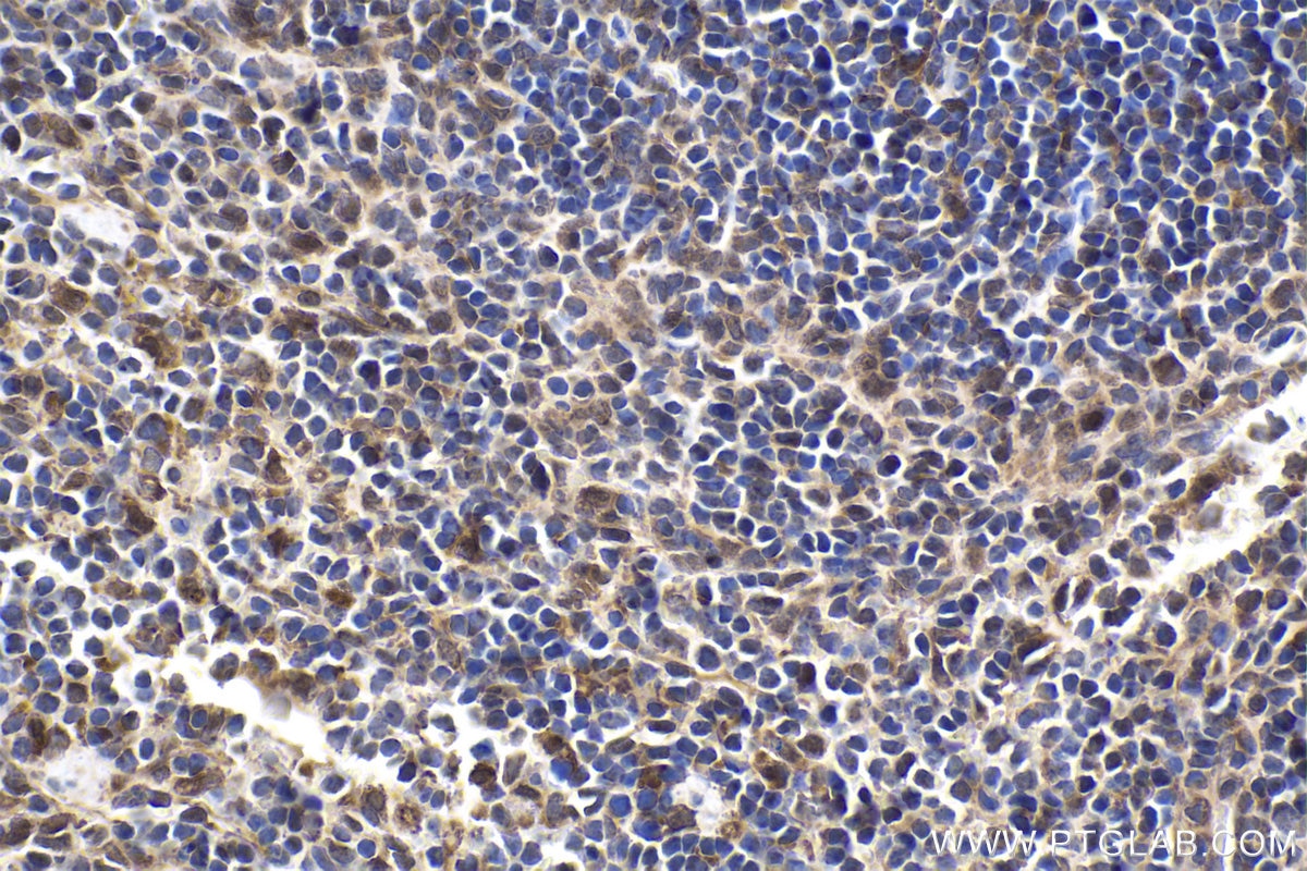 Immunohistochemical analysis of paraffin-embedded mouse spleen tissue slide using KHC1784 (CRTC2 IHC Kit).