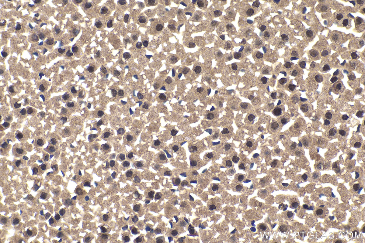 Immunohistochemical analysis of paraffin-embedded mouse adrenal gland tissue slide using KHC1792 (CRTC3 IHC Kit).