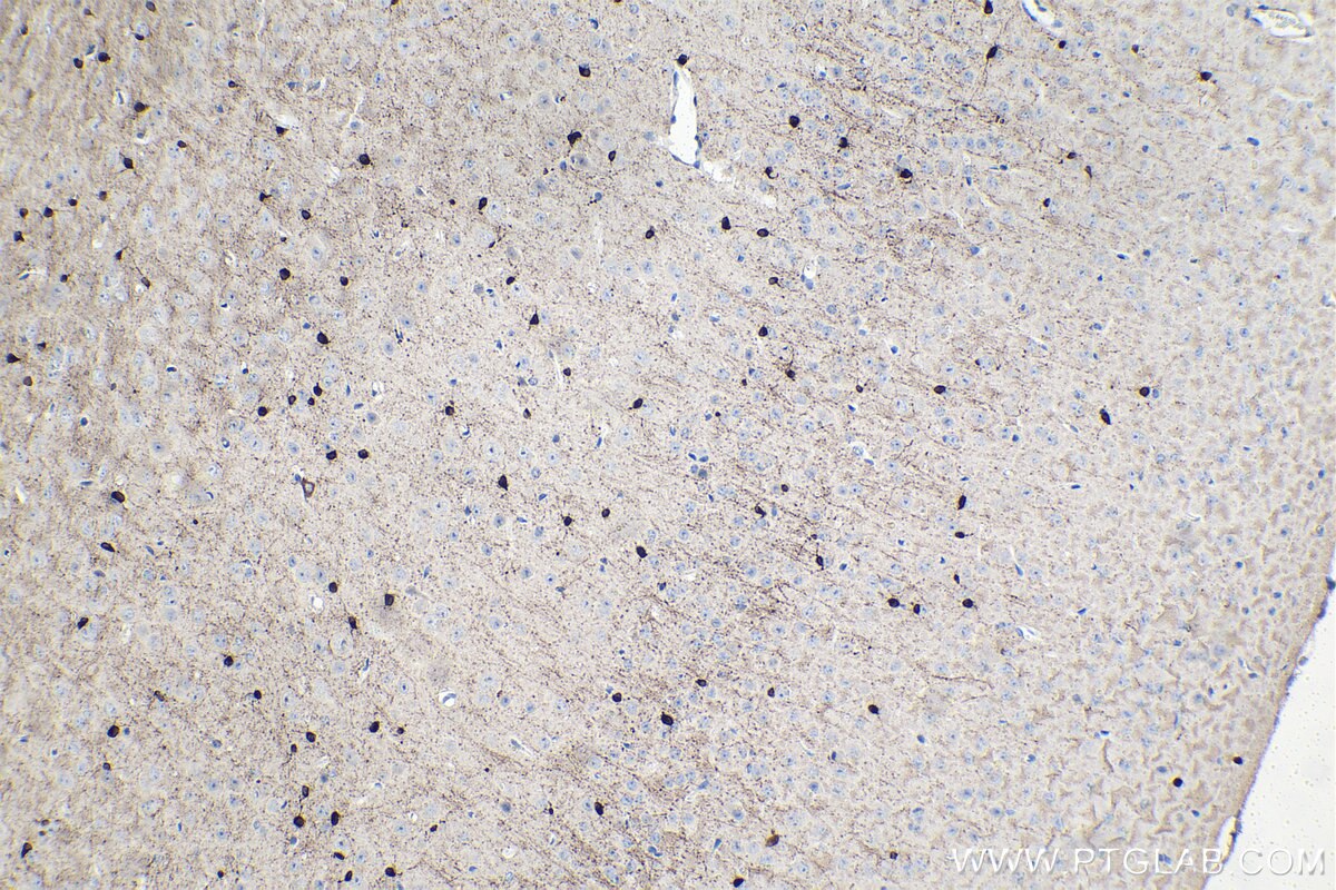 Immunohistochemical analysis of paraffin-embedded mouse brain tissue slide using KHC1503 (CRYAB IHC Kit).