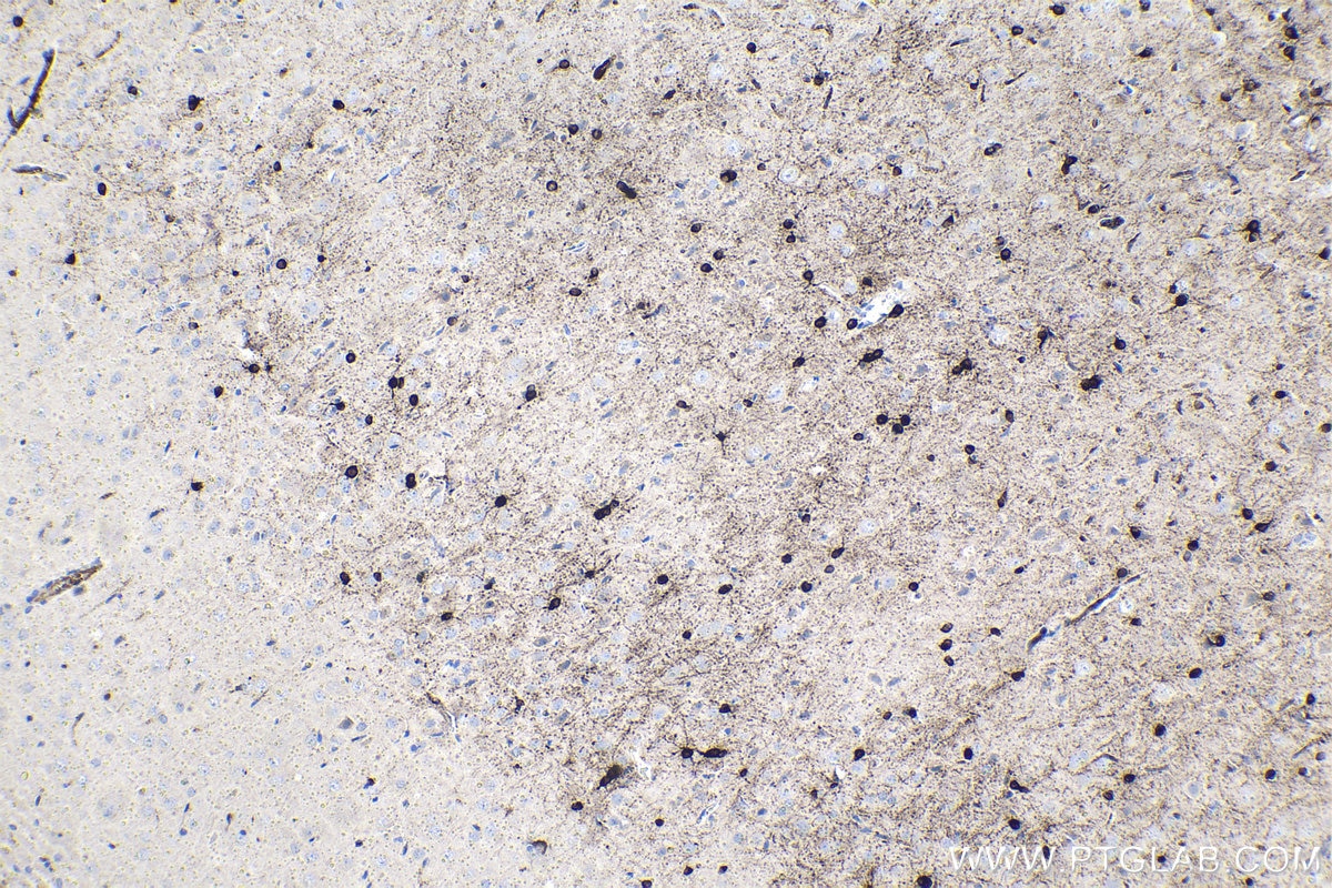 Immunohistochemical analysis of paraffin-embedded rat brain tissue slide using KHC1503 (CRYAB IHC Kit).