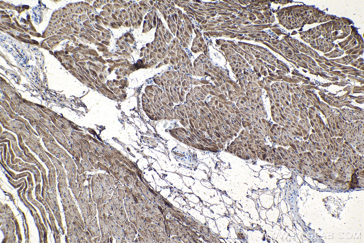 Immunohistochemical analysis of paraffin-embedded rat heart tissue slide using KHC1503 (CRYAB IHC Kit).