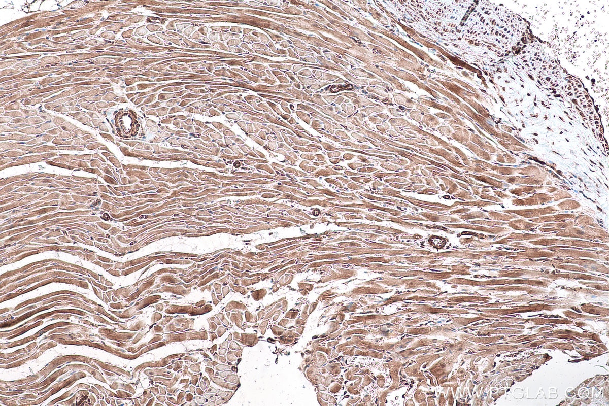 Immunohistochemical analysis of paraffin-embedded rat heart tissue slide using KHC0902 (CSDE1 IHC Kit).