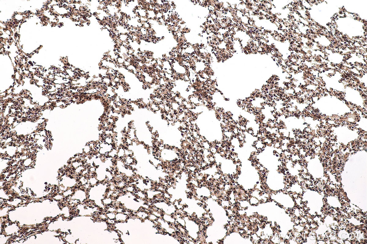 Immunohistochemical analysis of paraffin-embedded mouse lung tissue slide using KHC0779 (CSE1L IHC Kit).